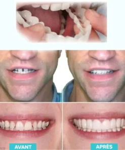 Fyndz™ Prothèses ajustables à clipser