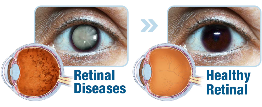 GFOUK™ OphthalTech Vision Vitality Electric Device 