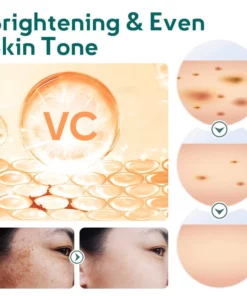 GFOUK™ Melanin Removal Booster Showerhead