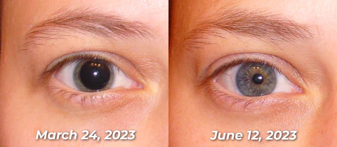 GFOUK™ OphthalTech Vision Vitality Electric Device