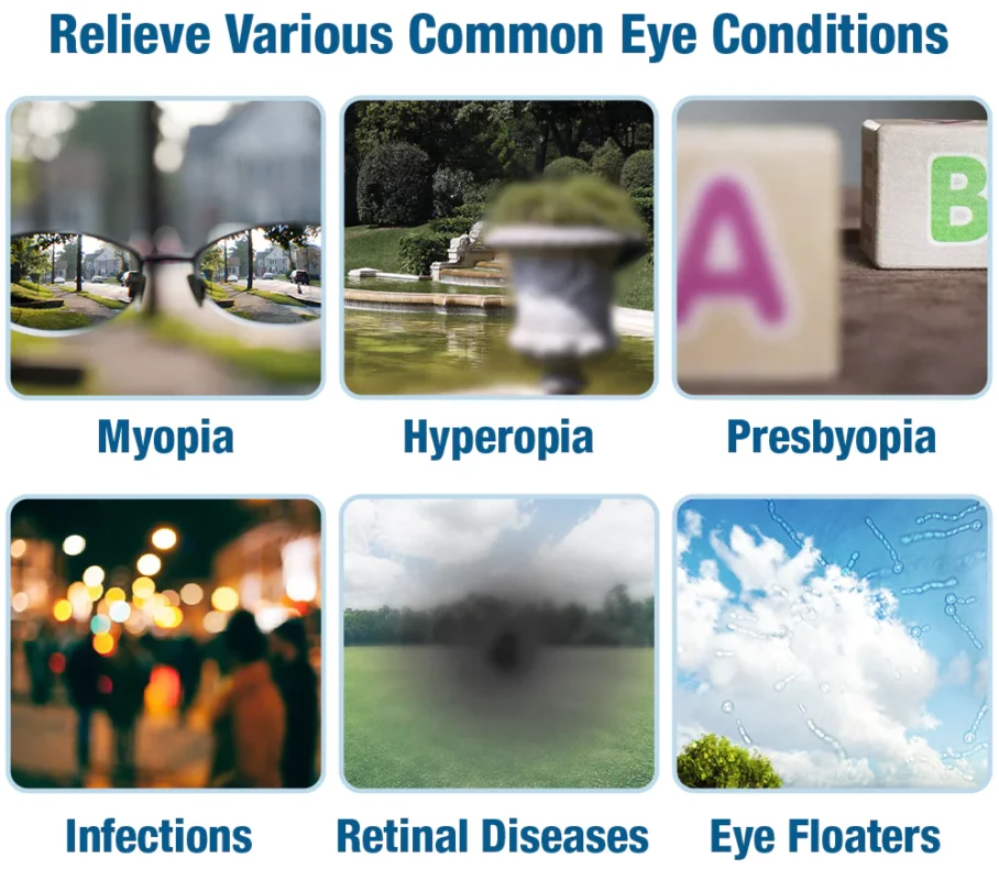 GFOUK™ OphthalTech Vision Vitality Electric Device