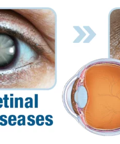 GFOUK™ OphthalTech Vision Vitality Electric Device