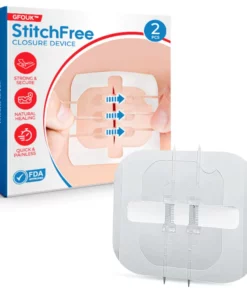 GFOUK™ StitchFree Closure Device