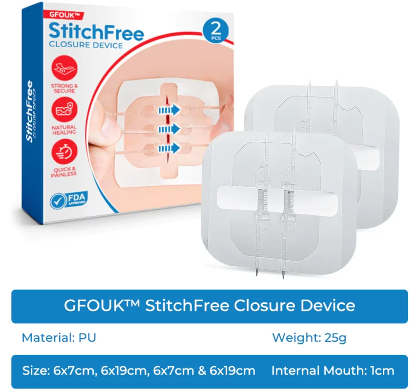 GFOUK™ StitchFree Closure Device