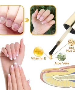 GFOUK™ VitaE Peeling Nail Serum