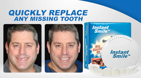 Instant Smile™ Temporary Teeth Kit