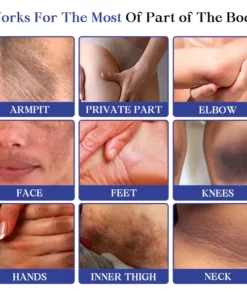 Kisshi™ Back Spots & Acanthosis Nigricans