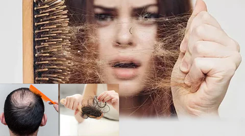 LIMETOW™ Anti-Hair Loss Ginger Shampoo Soap