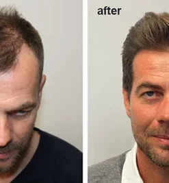 LIMETOW™ Anti-Hair Loss Ginger Shampoo Soap