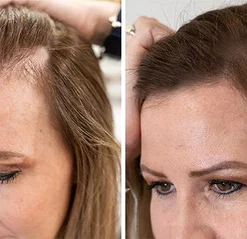 LIMETOW™ Anti-Hair Loss Ginger Shampoo Soap