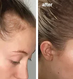 LIMETOW™ Anti-Hair Loss Ginger Shampoo Soap