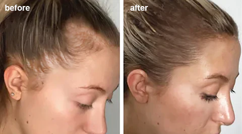 LIMETOW™ Anti-Hair Loss Ginger Shampoo Soap