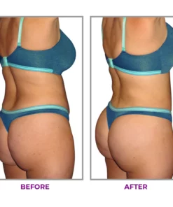 LIMETOW™ Hip Plump Capric Oil