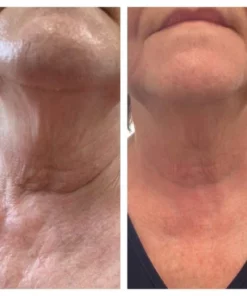 LIMETOW™ Lymphogermane Earrings