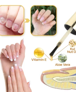 LIMETOW™ Peeling Nail Serum