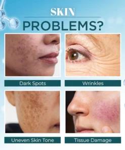 Lanthome™ Dark Spot Remover