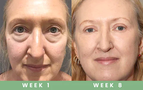 Msckt™ Plant extract eye spa steam eye mask