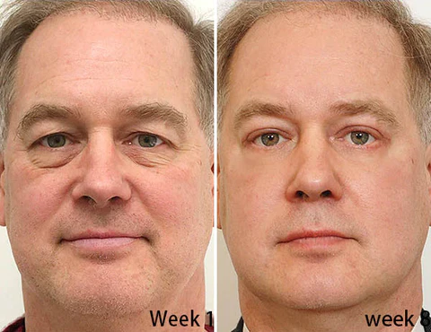 Msckt™ Plant extract eye spa steam eye mask