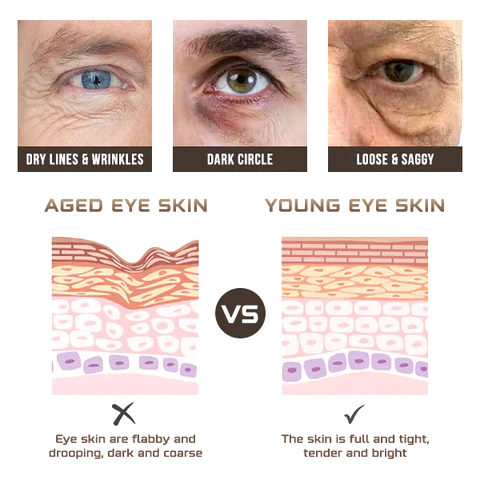 Msckt™ Plant extract eye spa steam eye mask