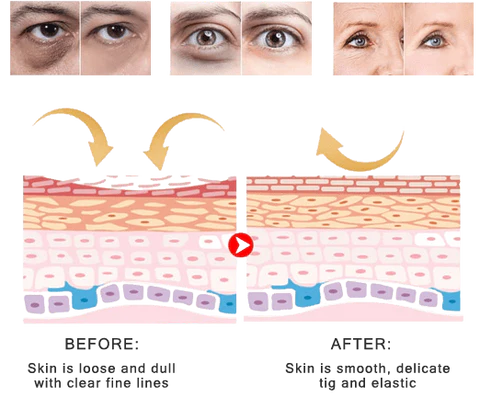 Msckt™ Plant extract eye spa steam eye mask
