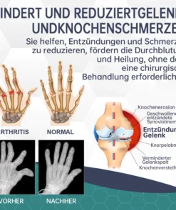 Neuseeland Bienenstich Gelenk-Bienenstich Schmerz- und Knochenheilungscreme