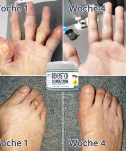 Neuseeland Bienenstich Gelenk-Bienenstich Schmerz- und Knochenheilungscreme