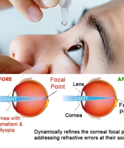 Optilize™ Eye Care Drops