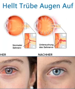 Ourlyard™ Augentropfen zur Behandlung von Sehproblemen