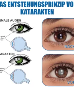 Ourlyard™ Augentropfen zur Behandlung von Sehproblemen