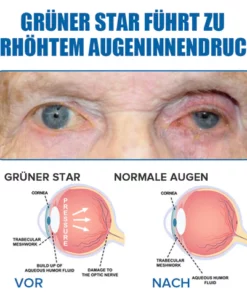 Ourlyard™ Augentropfen zur Behandlung von Sehproblemen
