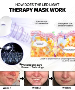 Ourlyard™ Laser Treatment Facial Mask for Rosacea