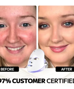 Ourlyard™ Laser Treatment Facial Mask for Rosacea