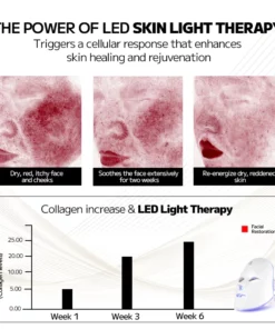 Ourlyard™ Laser Treatment Facial Mask for Rosacea