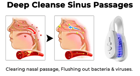 Oveallgo™ Breathe Well Nasal Mucus Cleaning Device