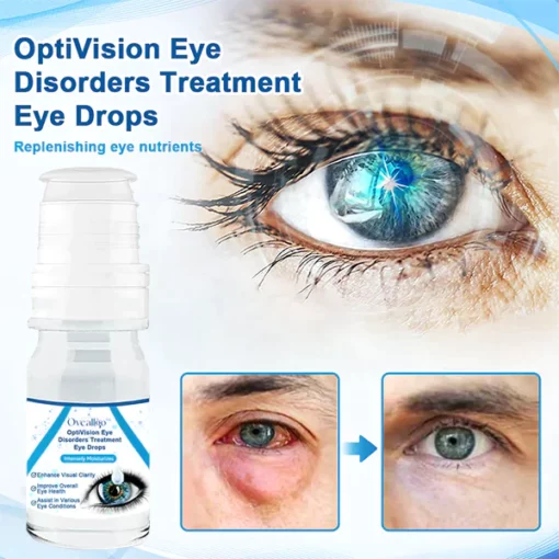 Oveallgo ™ روښانه OptiVision د سترګو اختلالاتو درملنه د سترګو څاڅکي