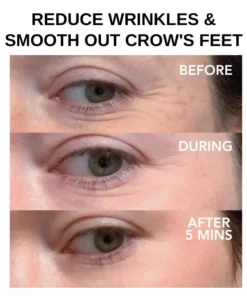 Oveallgo™ Clinical SkinCare مستحضر شد العين الفوري
