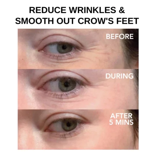 Oveallgo™ Clinical SkinCare مستحضر شد العين الفوري