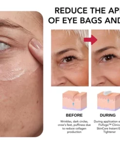Oveallgo™ Clinical SkinCare مستحضر شد العين الفوري
