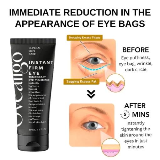 Oveallgo™ Clinical SkinCare مستحضر شد العين الفوري