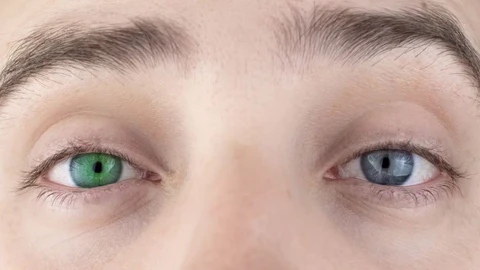 Oveallgo™ Colorful IrisInk Eye Drops