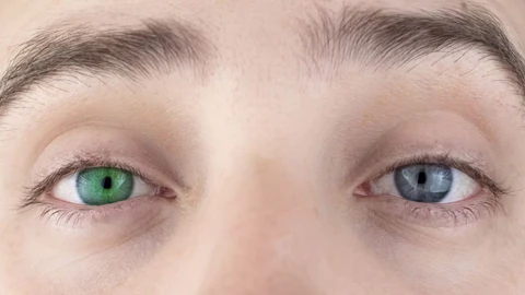 Oveallgo™ IrisInk Eye Drops
