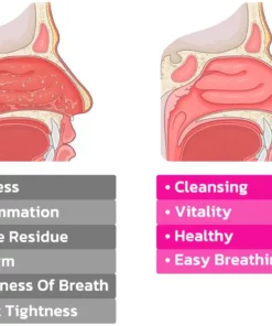 Fivfivgo™ BreathePure Nasenschleim-Reinigungsclip