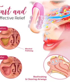 Oveallgo™ BreathePure Nasal Mucus Clearing Clip