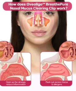 Oveallgo™ BreathePure Nasal Mucus Clearing Clip