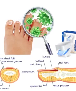 Oveallgo™ Expert Revolutionary High-Efficiency Light Therapy Device For Toenail Diseases