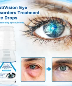 Oveallgo™ Gotas para los ojos para el tratamiento de los trastornos oculares OptiVision
