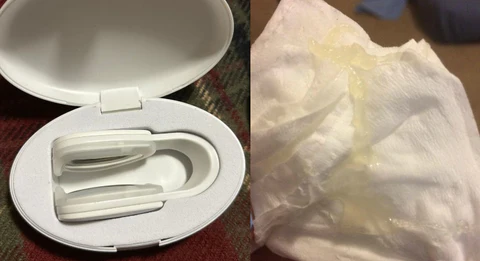 Oveallgo™ Nasal Mucus Professional Cleaning Device