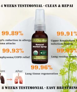 Oveallgo™ ProX Natural Herbal Spray for Lung and Respiratory Support