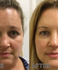 Oveallgo™ PureMe Korean Collagen Firming Mask