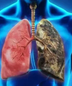 Oveallgo™ RespireWell Herbal Spray for Lung and Respiratory Support